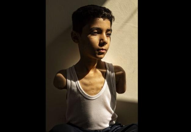 عکس کودک فلسطینی،‌ برنده ورلدپرس۲۰۲۵ شد