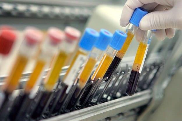 اسامی ۱۵ دوپینگی در سال ۲۰۲۵