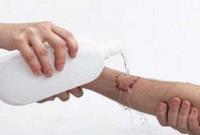  مرگ ۶ نفر بر اثر ابتلا به «هاری» در کشور