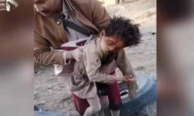 بمباران یمن توسط جنگنده‌های متجاوز سعودی-آمریکایی