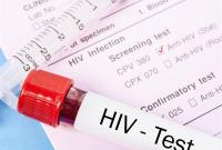 ۵۵ هزار نفر مبتلا به اچ. آی. وی در کشور داریم