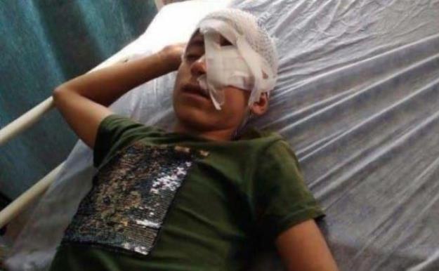 سقوط کولبر ۱۴ ساله از کوه/ درمان بدلیل مشکلات مالی متوقف مانده