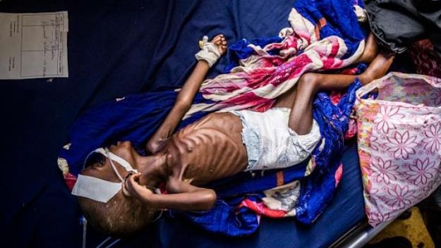 سازمان ملل: سومالی در آستانه قحطی قرار دارد